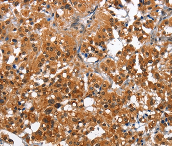 CAMK1D Antibody