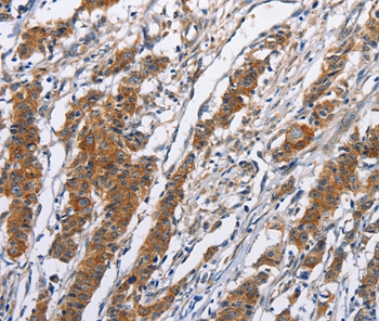 NCAPD3 Antibody