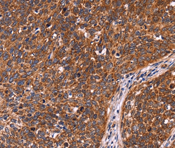 CCDC106 Antibody