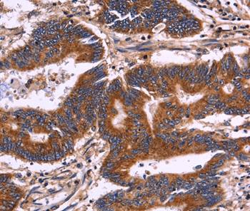 KIR2DL3/1/4/S4 Antibody