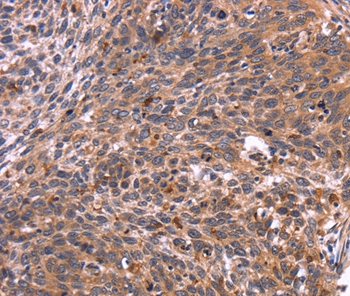 CRK Antibody