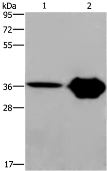 CXCR6 Antibody