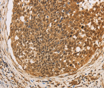 CXXC5 Antibody