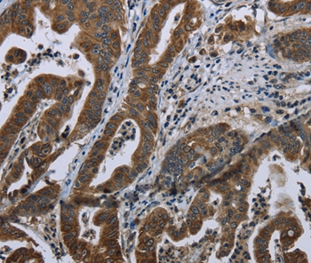 BRINP1 Antibody