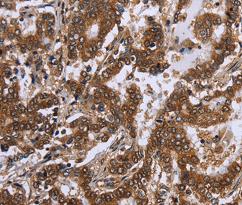 FGF21 Antibody