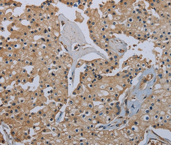 FLCN Antibody