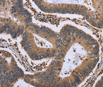 GADD45B Antibody