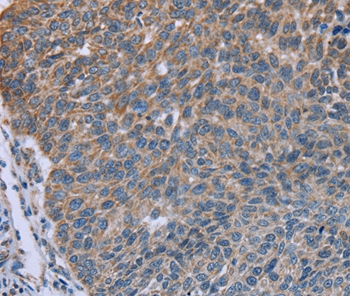 GNAI3 Antibody