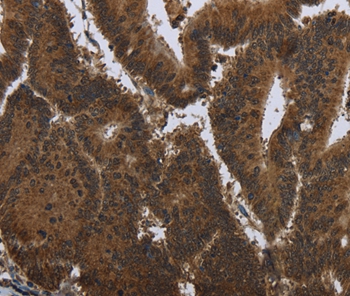 PIP Antibody