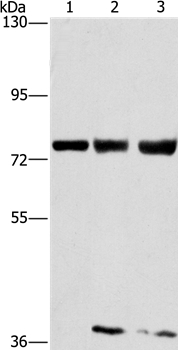 GGCX Antibody