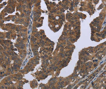 GYS2 Antibody