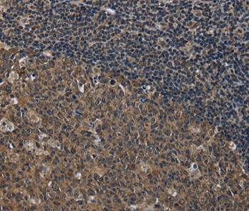 SETD7 Antibody