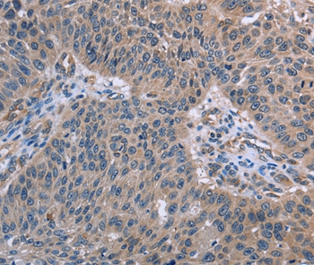 RNF144B Antibody
