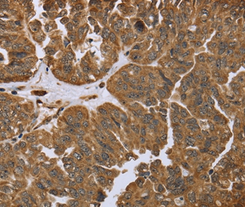 IKBIP Antibody