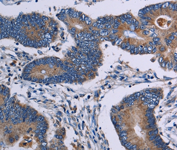 ITK Antibody