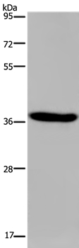 KCNK17 Antibody