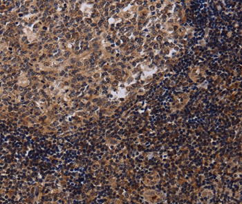 NTMT1 Antibody