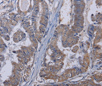 TRPM8 Antibody