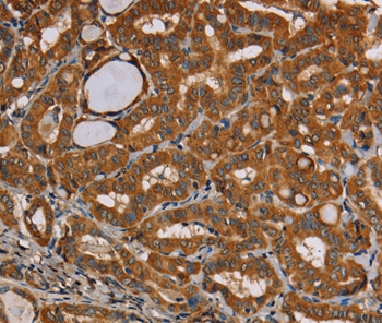 CENPU Antibody