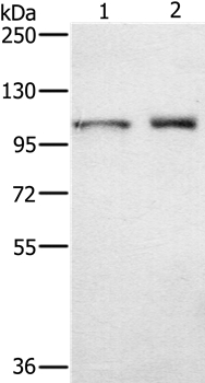 ODF2 Antibody