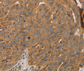PARP11 Antibody