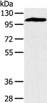 PYGM Antibody