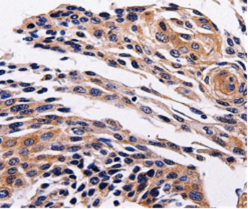 ADRB1 Antibody