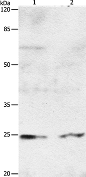 RAB8A Antibody