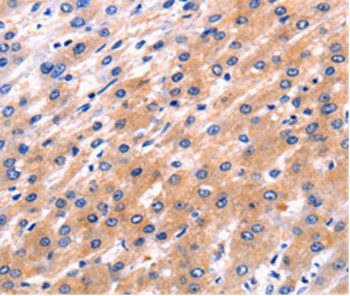 RAB39 Antibody