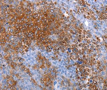 AQP5 Antibody