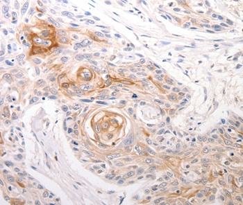 DFFB Antibody