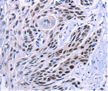 CREBBP Antibody