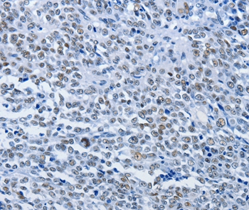 CBX1 Antibody