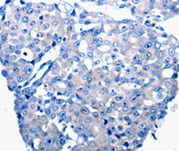 CCL2 Antibody