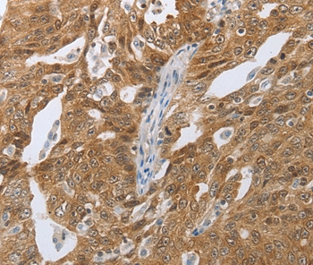 CEBPA Antibody