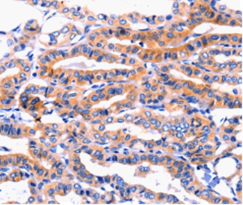 CFTR Antibody