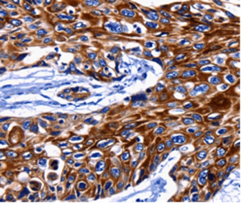 KRT10 Antibody