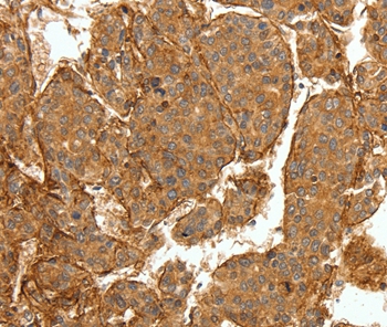 COL4A1 Antibody