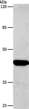 CTGF Antibody