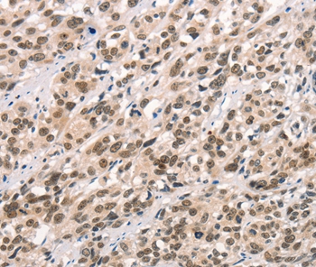 CCNT1 Antibody