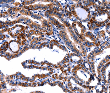 FBN1 Antibody
