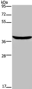 FOXE1 Antibody