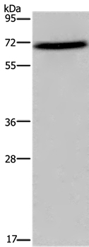 FOXO1 Antibody