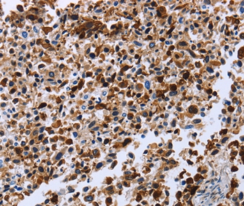 CXCR3 Antibody