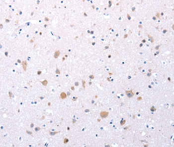 CCKAR Antibody