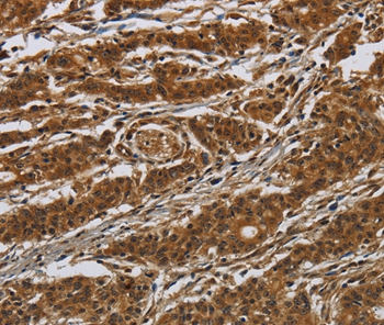 GATA5 Antibody