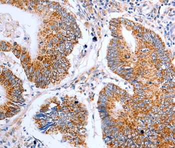 CLDN10 Antibody