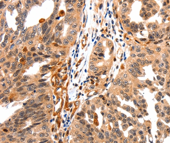 GAS6 Antibody