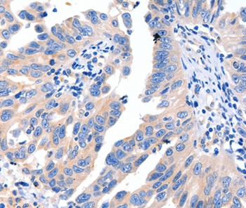 MSTN Antibody