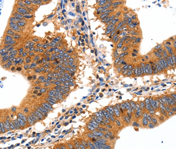 SLC2A2 Antibody